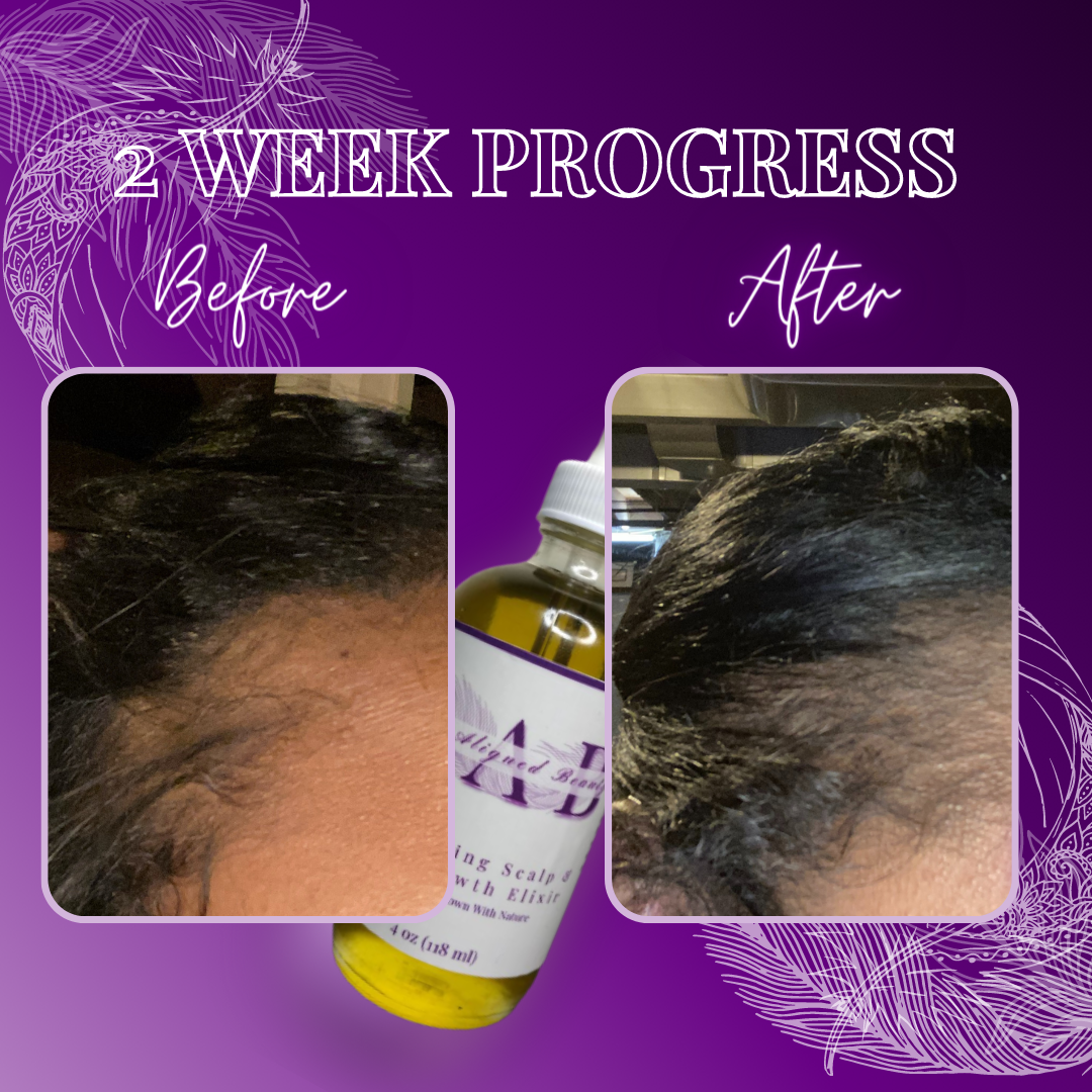 Stimulating Scalp & Hair Growth Elixir - 4oz